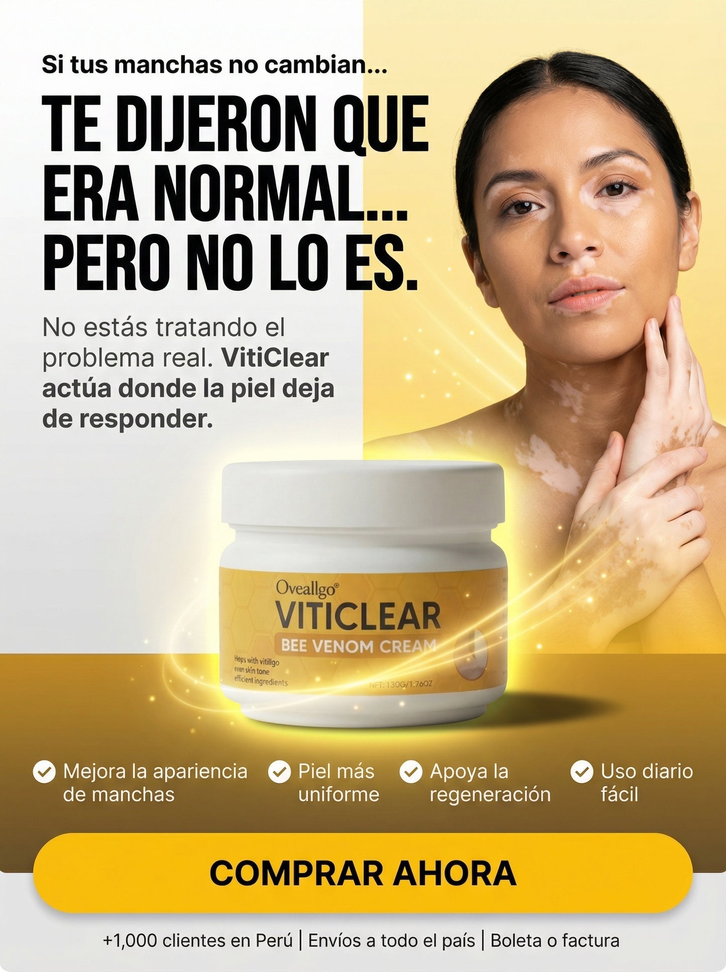 Viticlear Crema Soporte para Vitiligo USA