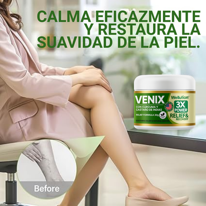 Crema VENIX - Alivia el dolor de varices