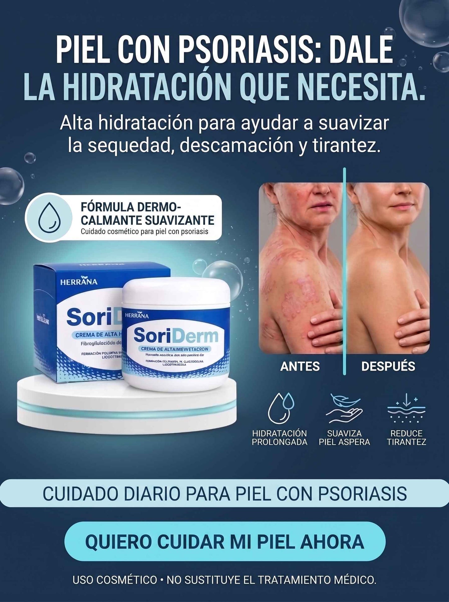 SoriDerm – Crema Hidratante para Piel Seca y con Psoriasis |